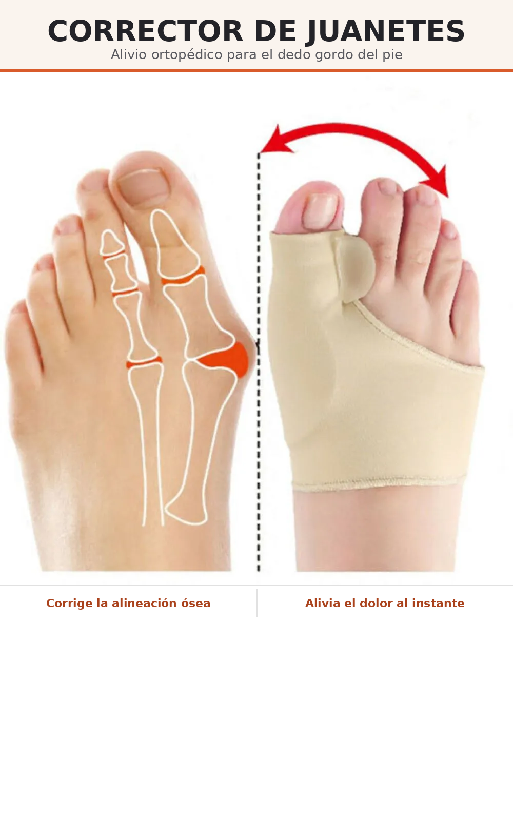 Corrector de Juanete